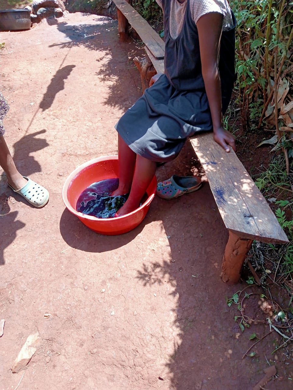Jiggers Eradication at Gekomoni Village